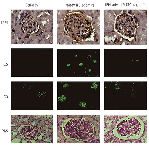Fig A: These images show the deposition of immune complexes and the complement protein C3, as analyzed by immunofluorescence. PAS-stained kidney sections were analyzed for renal lesion scores, which showed that miR-130b agomir ame-liorated interferon-α-accelerated lupus nephritis (LN) in mice.